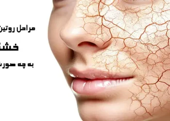 روتین پوست خشک