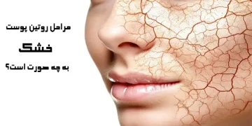 روتین پوست خشک