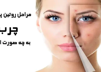 روتین پوست چرب به چه صورت است ؟