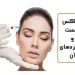بوتاکس