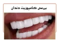 کامپوزیت دندان