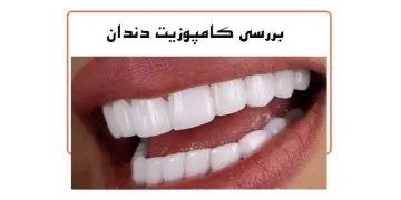 کامپوزیت دندان
