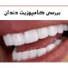 کامپوزیت دندان