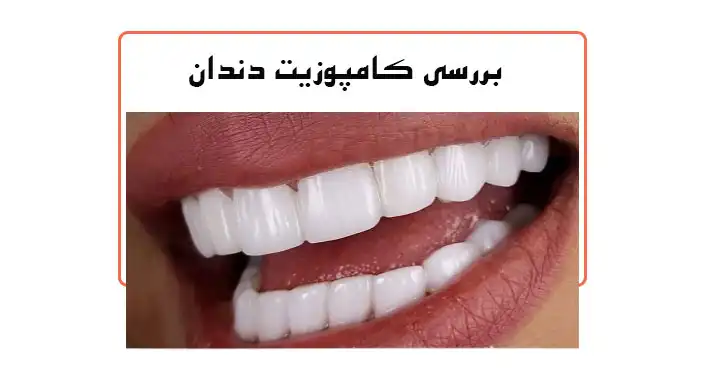 کامپوزیت دندان