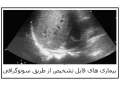 سونوگرافی