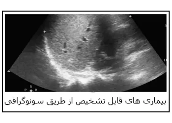 سونوگرافی