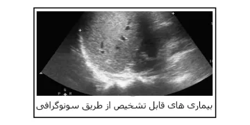 سونوگرافی