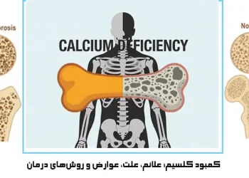 کمبود کلسیم