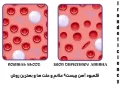 کمبود آهن